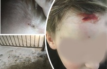 В Ярославле поскользнувшийся школьник упал лицом на забор
