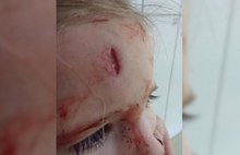 Ребенок рассек лоб в «Ауре» в Ярославле: ответ администрации